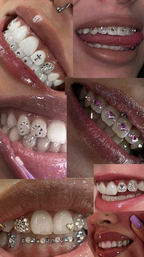 Silver Teeth Aesthetic, Tooth Gems Braces, Teeth Gem Designs, Tooth Gems Design, Strass Teeth, Girly Grillz, Brackets Aesthetic, Teeth Jewels, Teeth Gems Diy