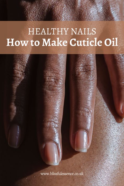 Homemade Cuticle Oil, Nail Remedies, Natural Nail Care, Nail Infection, Diy Beauty Treatments, Cuticle Care, Nail Care Tips, Nail Care Routine, Nail Oil