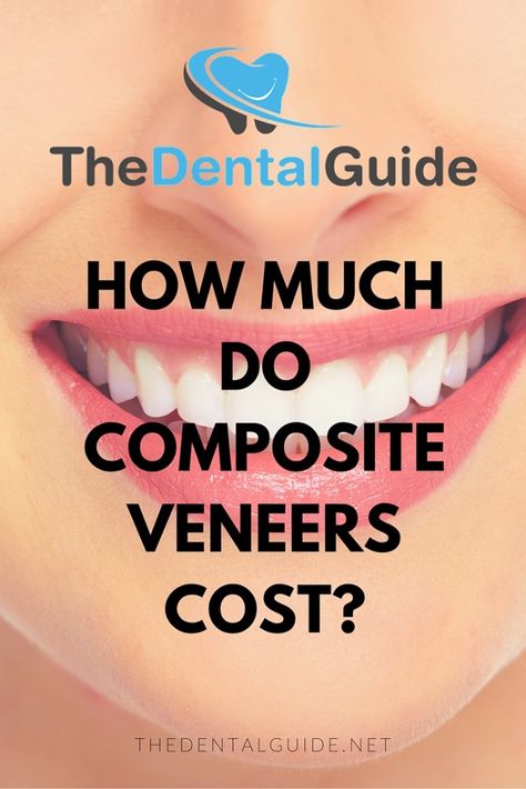 How Much Do Composite Veneers Cost? - The Dental Guide http://www.thedaviedentist.com/home Composite Veneers Teeth, Veneers Teeth Cost, Composite Bonding, Dental Composite, Teeth Aesthetic, Composite Veneers, Pretty Teeth, Veneers Teeth, Tooth Replacement