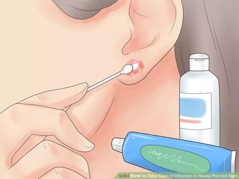 Image titled Take Care of Infection in Newly Pierced Ears Step 3 Every Ear Piercing, Infected Nose Piercing, Infected Ear Piercing, Ear Piercing Care, Baby Ear Piercing, Cleaning Piercings, New Ear Piercing, Ear Wax Buildup, Getting Your Ears Pierced