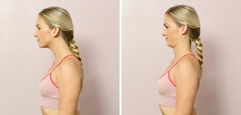 Tech Neck Stretches, Yoga Neck, Bell’s Palsy, Neck Posture, Better Posture Exercises, Chin Tuck, Repetitive Strain Injury, Tech Neck, Sore Neck