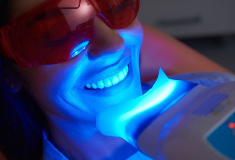 Teeth Whitening Procedure, Laser Teeth Whitening, Teeth Bleaching, Dental Cosmetics, Natural Teeth Whitening, Natural Teeth, Krav Maga, Whitening Kit, Teeth Whitening Kit