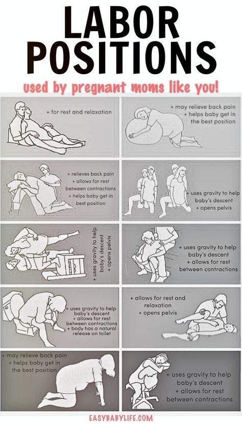 Looking for the best labor positions for easier childbirth? It is still quite common to lie flat on your back during labor and delivery despite being one of the worst birth positions! Curious about which positions other pregnant moms used? Check out this survey of more than 500 moms (and share your own experience)!   Important childbirth education and preparation, pregnancy care, pregnancy help for easy labor, and unmedicated birth tips. Birth Positions, Birth Tips, Labor Positions, Baby Weeks, Easy Labor, Third Trimester Pregnancy, Unmedicated Birth, Pregnancy Help, Baby Delivery