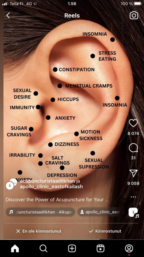 Ear Acupressure, Internal Health, Healing Reflexology, Woman's Health, Ear Reflexology, Ear Seeds, Ear Acupuncture, Acupressure Therapy, Reflexology Chart