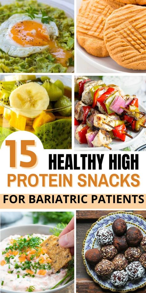 If you have recently had gastric bypass surgery and are looking for healthy snacks to eat, then you need these recipes! These are the best high-protein snacks for people who have had weight loss surgery.Gastric Bypass Snacks.Protein Snacks Recipes.Gastric Bypass Recipes.Healthy High Protein Snacks.Healthy High Protein Snacks Caloric Bypass Diet, Gastric Bypass Sleeve Post Op Liquid Diet, Bariatric Snack Recipes, Post Op Bariatric Recipes Liquid Diet, Gastric Bypass Snack Ideas, Gastro Bypass Recipes, Post Gastric Bypass Meal Plan, Gastric Bypass Snacks, Gastric Bypass Recipes Pureed Soft Foods