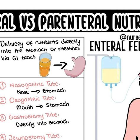 Dr. Nurse Vicky (Fiskvik Antwi) on Instagram: "Wondering what is the difference between enteral and parenteral nutrition? Here is a quick review nursing students!
.
.
.

#nclexpn #nclexrn #nclexstudying #nclexprep #nclexreview #nclextips #nclexhelp #nurseintraining #futurern #futurerns #futurernbsn #futurenurse💉 #futurenursepractitioner #nurseinprogess #studynursing #nursepractitionerstudent #nursingstudent #nurseschool #lpnstudent #lpns #nursestudents #nursingschool #nclex #rn #rnstudent #nurse" Nutrition Nursing, Parenteral Nutrition, Lpn Student, Nurse Practitioner Student, Nclex Pn, Nclex Review, Nclex Prep, Future Nurse, Nursing Education