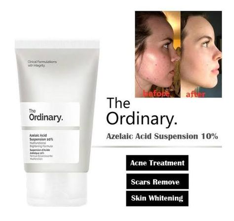 The Ordinary Azelaic Acid, Haut Routine, Skin Care Basics, Skin Care Routine Order, Clear Healthy Skin, Natural Face Skin Care, Serious Skin Care, Skin Care Tutorial, Basic Skin Care Routine