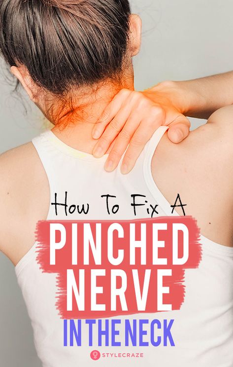 How To Fix A Pinched Nerve In The Neck – Causes, Symptoms, And Remedies Migraine Facts, Pinched Nerve In Neck, Natural Headache, Pinched Nerve, Natural Headache Remedies, Chiropractic Adjustment, Nerve Pain Relief, Neck Pain Relief, Natural Healing Remedies