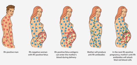 Rh Mismatch What Does It Mean To You And Your Baby A Negative Blood, Abo Blood Group System, Rh Factor, Tissue Biology, Rh Negative, Ancient Astronaut Theory, Clinical Chemistry, Blood Group, Human Body Organs