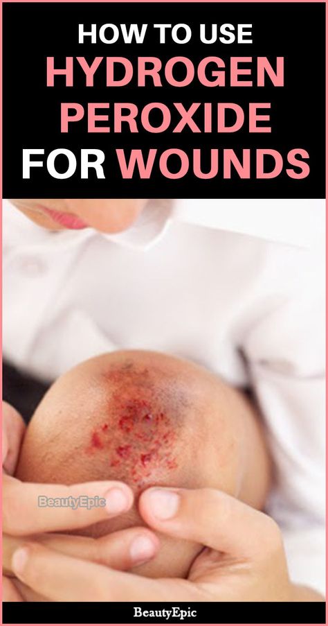 How to Use Hydrogen Peroxide for Wounds Hydrogen Peroxide Hair, Hydrogen Peroxide Skin, Hydrogen Peroxide Uses, Health World, Hydrogen Peroxide, Skin Care Remedies, Moisturizing Body Wash, Garden Tips, Beauty Recipe