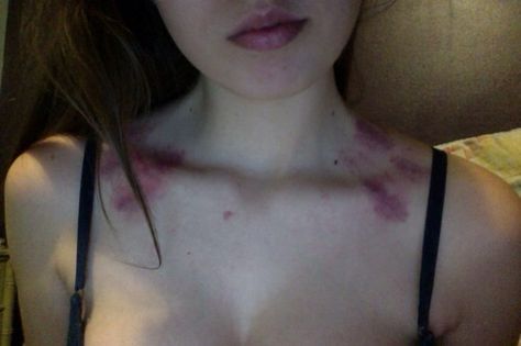 Love bites. Love, bites. Cute Hickies Neck, Hickies Neck Anime, Hickies Neck Girl, Hickey Neck Tattoo, Love Bites Hickey For Boys, Hickies Neck Boys, Love Bites Aesthetic, Hickies Girl, Hickies Neck Aesthetic Girl