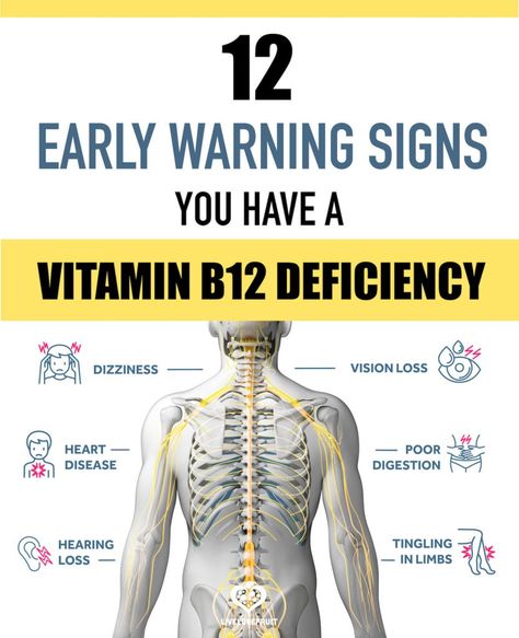 graphic of body with neural system with text - 12 early warning signs you have a vitamin b12 deficiency B12 Deficiency Symptoms, Deficiency Symptoms, B12 Deficiency, Vitamin B12 Deficiency, Vitamin Deficiency, Vitamin B12, Health Facts, Vitamin B, Warning Signs