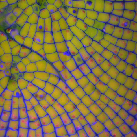 Plant Cells, Microscopic Photography, Microscopic Images, Cell Structure, Plant Cell, Things Under A Microscope, Natural Forms, Yellow And Blue, Mellow Yellow