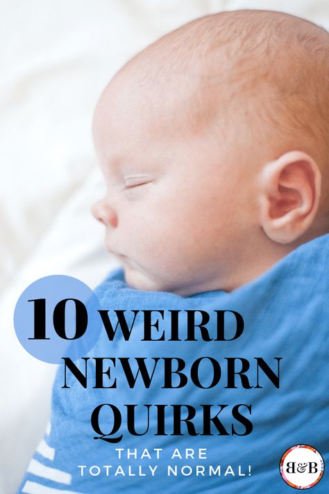 Ever been grossed out by baby crusty eye? Or wondered if it’s normal for your newborn’s skin to peel? That’s understandable since there are a lot of weird things that happen with these cute little babies! Watch the video below for 10 really strange quirks you might see. Newborn Skin Peeling, Crusty Eyes, Social Media Website Design, Media Website Design, Allergy Eyes, Baby Acne, One Month Baby, Baby Eyes, Peeling Skin