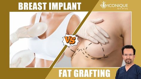 Breast Implant or fat grafting- which one is best? Fat Grafting Breast, Fat Grafting, Breast Augmentation, Delhi Ncr, Live Lokai Bracelet