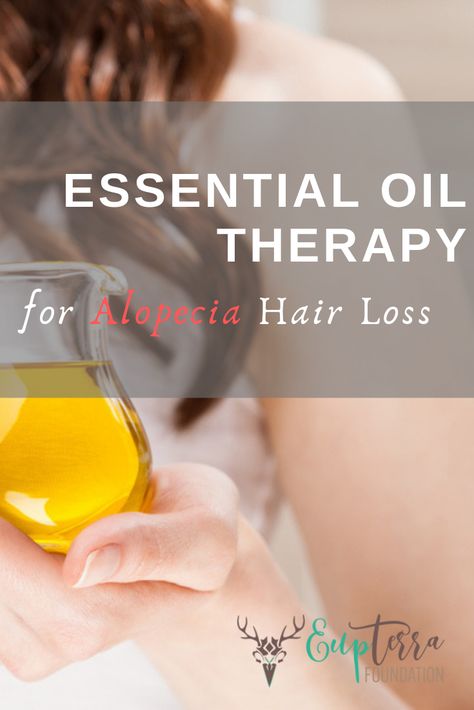 Of the many treatments available for alopecia areata, a Scottish study found that a specific blend of essential oils can treat alopecia effectively. Oil Therapy, Detox Tips, Natural Health Care, Natural Health Tips, Holistic Medicine, Balanced Lifestyle, Natural Health Remedies, Holistic Wellness, Natural Cleaning Products