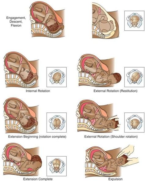 Fetal Presentation, Cardinal Movements Of Labor, Doula Bag, Nursing Instructor, Newborn Nursing, Midwifery Student, Medical Illustrations, Nursing Motivation, Birth Education