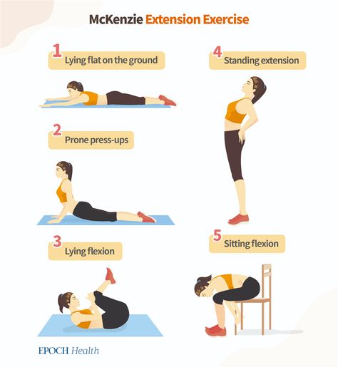 Slipped Disk Stretches, Cervical Disc Exercises, Stretches For Herniated Disk, Herniated Disk Exercises, Disk Herniation Physical Therapy, Slipped Disk Symptoms, Stretches For Bulging Disc In Lower Back, Slip Disc Exercises, Slipped Disk Relief