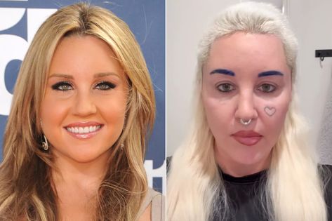 Amanda Bynes Feels Confident After Bleph Surgery Amanda Bynes Now, Thousand Oaks California, What A Girl Wants, Amanda Bynes, American Pie, Thousand Oaks, Sketch Comedy, Acting Career, Nickelodeon