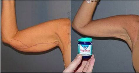 Despídete de la flacidez de los brazos con el producto Vick Vaporub, podrás despedirte de tu amigos agitando los brazos como tu quieras https://co.pinterest.com/pin/1037305726644170699 Allergy Remedies, Organic Remedy, Natural Cold Remedies, Health Trends, Vicks Vaporub, Cold Remedies, Online Workouts, Herbal Medicine, Health Remedies