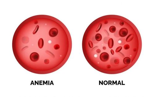 Causes of High and Low Hemoglobin Levels - Facty Health Medical Assistant Student, Hemoglobin Levels, Penyakit Jantung, Cells And Tissues, Iron Rich Foods, Pulmonary Disease, Soy Products, Nursing Tips, Red Blood Cells