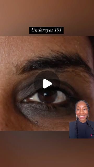 Dr Kemi Fabusiwa on Instagram: "Undereyes 101: Banish those dark circles and bags! 😴✨

Dark Circles:
➡️Retinoid eye cream to brighten @officialmedik8 crystal retinal eye cream 
➡️Under-eye SPF with pigment to conceal ☀️ @larocheposay Melasyl SPF

Puffy Eyes:
➡️Caffeine eye cream to de-puff ☕ @lorealparis caffeine eye cream
➡️Hyaluronic acid to hydrate and plump @neutrogenaukire 

Sunken Eyes:
➡️Peptide eye cream to boost collagen @cosrx peptide eye cream
➡️Retinoid eye cream to thicken skin @larocheposay redermic retinol eye cream 
➡️Hyaluronic acid for added volume @neutrogenaukire hyaluronic acid eye cream 

#undereyecare #skincare #beautyhacks #eyecream #darkcircles #puffyeyes #skincareroutine" Caffeine Eye Cream, Sunken Eyes, Retinol Eye Cream, Boost Collagen, Puffy Eyes, Glass Skin, All Things Beauty, Eye Cream, Retinol