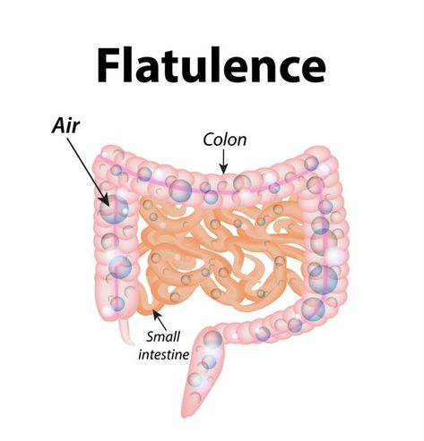 Foods to Avoid on the Low-Flatulence Diet - Facty Health Non Gassy Foods, Gassy Foods, Small Intestine, Colon Health, Starchy Foods, Fava Beans, Average Person, Large Intestine, Butter Beans