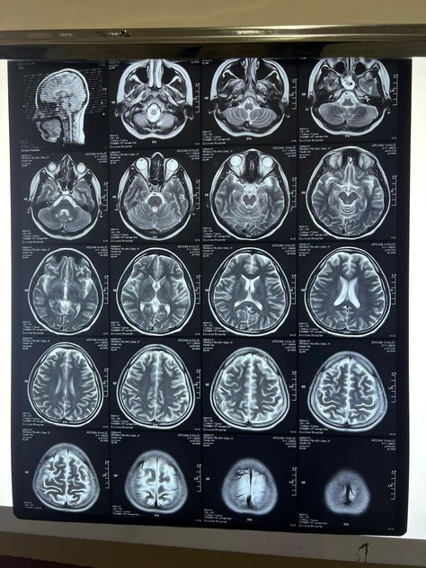 Forensic Psychiatrist, Mri Technologist, Mri Brain, Stay Rad, Medical Engineering, Case Presentation, Short Notes, Literature Review, Brain Chemistry