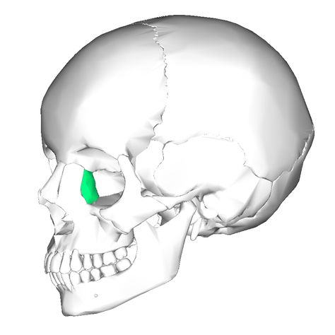 Lacrimal bones: 2 bones. Medial walls of orbit . Contain lacrimal fossa (deep groove) that houses for lacrimal sac (collect tears from the surface of eyes) Lacrimal Bone, Anatomy Flashcards, Cheek Implants, Anatomy Images, Body Bones, Facial Bones, Doll Therapy, Craniosacral Therapy, Human Body Anatomy