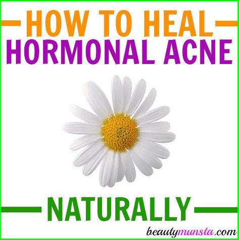 If you want to treat your hormonal acne naturally, follow this DIY hormonal acne protocol! It uses natural ingredients and simple holistic approaches to manage hormonal acne! Causes of Hormonal Acne What is hormonal acne? It’s simply acne caused by excess hormones in the body, especially the hormone testosterone. Now both men and women have … #AcneCauses Acne Men, Natural Acne Remedies, Natural Acne, Acne Causes, Hormonal Acne, Cystic Acne, Acne Free, Acne Remedies, How To Get Rid Of Acne