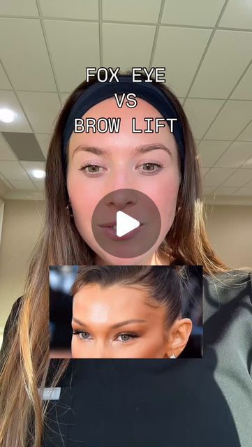 Brett, APRN NP-C • Atlanta injector on Instagram: "What’s your go to? 

I love having options I personally opt for the traditional brow lift since I like the little arch in my brow but that’s just personal preference! Lmk your fav ❤️

Follow @injector_brett for more content like this 🫶

…

#browliftbotox #eyebrowlifting #foxeye #atlantabotox #injector" Fox Eye Thread Lift Before And After, Eye Brow Lift Before And After, Brow Lift Botox Before And After, Botox For Eyebrow Lift, Botox Eye Lift, Fox Eye Botox Before And After, Platysmal Band Botox Before And After, Botox For Hooded Eyes, Nose Botox Before And After