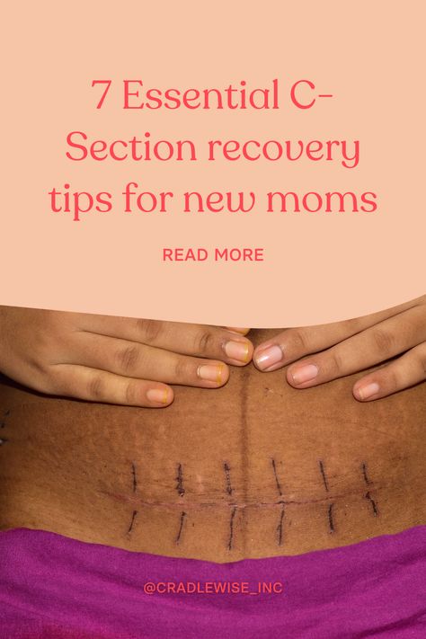 If you're recovering from a C-section, these tips can help you recover faster and get back to your daily routine. Learn how to take care of yourself and heal properly after a C-section with this helpful guide. Recovery After C Section, Recovering From C Section, 3 Weeks Postpartum, Tips For New Moms, C Section Recovery, Abdominal Surgery, C Section, Postpartum Recovery, Breast Pumps