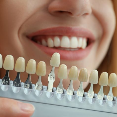 Our custom veneers are designed to enhance your unique features, giving you the confidence to smile wide. Ready to transform your smile? Schedule your consultation today!   Call us ☎️ 770-889-5335 #APlusDentistry #DrFarhang #CosmeticDentistry #Veneers Gum Surgery, Kedokteran Gigi, Porcelain Veneers, Dental Veneers, Pediatric Dentistry, Best Dentist, Perfect Smile, Healthy Smile, Cosmetic Procedures