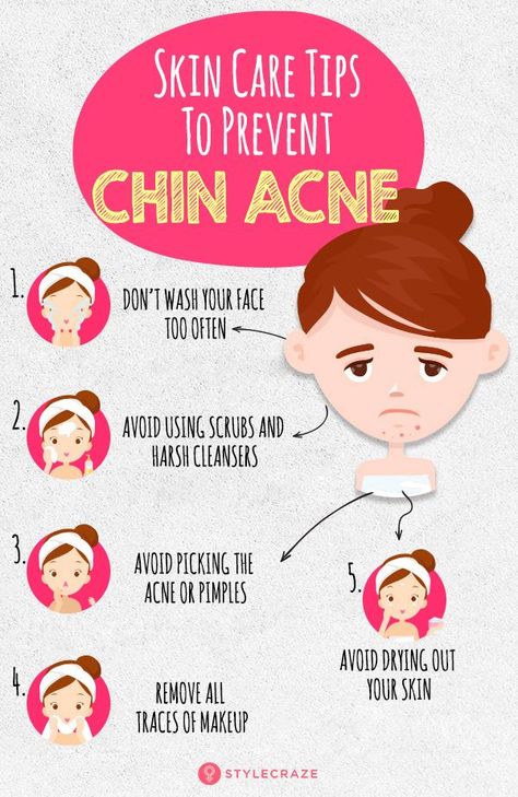 Chin Acne: What Is It, Causes, And How to Get Rid of It 😘 how to get rid of breakouts, fine lines in skin, treatments for under eye lines 🌸 #dermatology #sunscreen #psoriasis Chin Acne Causes, Chin Acne, Blind Pimple, Pimples Under The Skin, Bad Acne, Acne Overnight, Pimples Overnight, Prevent Pimples, Ac New Leaf