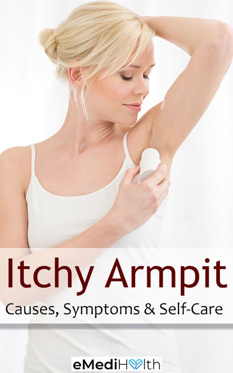 Armpit Rash Remedy, Itching All Over, Itchy Skin Remedies, Itchy Armpits, Heat Rash Remedy, Itchy Underarms, Home Remedies For Rashes, Get Rid Of Candida, Smelly Underarms