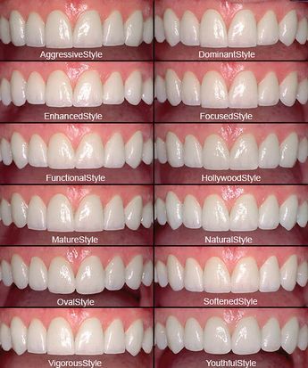 Natural Teeth Whitening Diy, Pretty Teeth, Teeth Design, Veneers Teeth, Teeth Whitening Diy, Mom Activities, Beautiful Teeth, Dental Facts, Laser Teeth Whitening