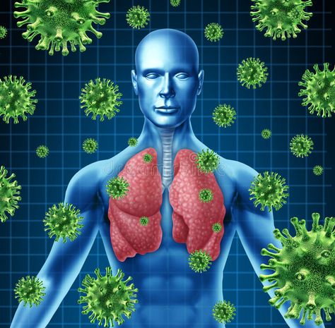 Lung infection. Represented by a human with x-ray image of the lungs and body wi , #Ad, #image, #ray, #body, #lungs, #infection #ad Mucus In Throat, Getting Rid Of Mucus, Clear Lungs, Foods High In Magnesium, Home Remedies For Bronchitis, Lung Infection, Persistent Cough, Viral Infection, How To Make Drinks