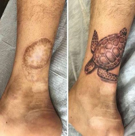 Un tatouage tortue de mer qui couvre parfaitement cette cicatrice Tattoo Over Scar, Scar Cover Up, Tattoos To Cover Scars, Scar Tattoo, Clever Tattoos, Skeleton Hand Tattoo, Geniale Tattoos, Incredible Tattoos, Tattoo Cover