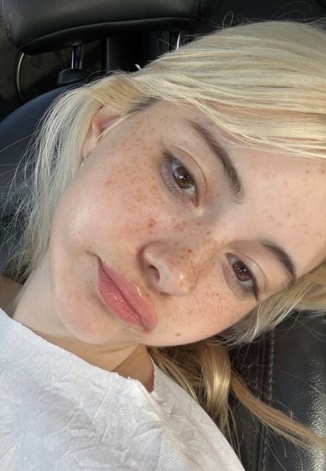 Sephira Lily, Freckles Aesthetic, Lovegood Aesthetic, Luna Lovegood Aesthetic, Cute Freckles, Fake Freckles, Freckles Makeup, Beauty Marks, Freckles Girl