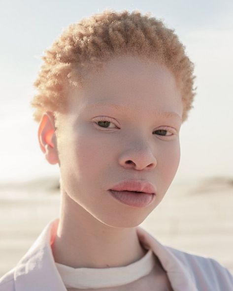 Albino Black People, Albino Model, Brown Girls Makeup, Face Study, Different Kinds Of Art, Art Photography Portrait, Face Reference, We Are The World, Oc Ideas