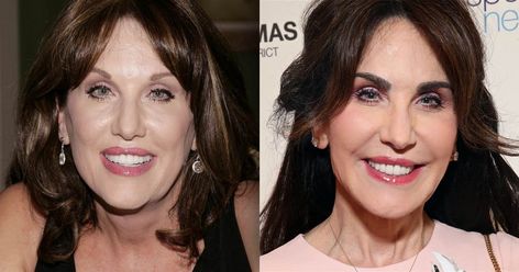 The author is opening up about the cosmetic procedure that gave her a boost of confidence. Robin Mcgraw Plastic Surgery, Robin Mcgraw, Dr Phil Show, Eyebrow Transplant, Plastic Surgery Photos, Celebrity Plastic Surgery, Dr Phil, Eye Brows, Botox Injections