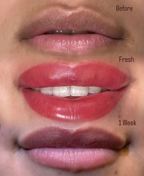 The art of Lip Neutralization 🤩 I’m obsessed with these results! Just one week after and you can see how the hyperpigmentation has been camouflaged with the implementation of ink. Choosing the right pigment is crucial when neutralizing. I can’t wait to see the color bloom around week 8-12! Are you wanting to camouflage hyperpigmentation and get an even base color for your lips? Then Lip Neutralization is for you! DM for booking or inquiries _________________________________ #lipneutral... Lip Neutralization, Lips Inspiration, Choose The Right, Base Colour, Blush, Lips, Color