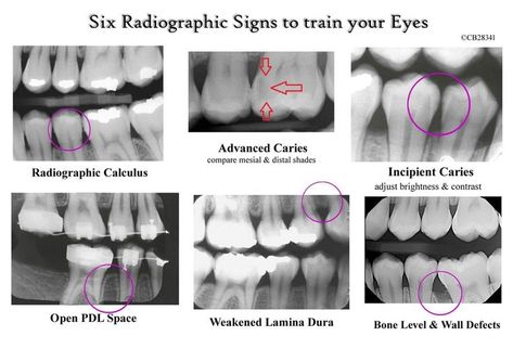 Pin by Angela Chan on D E N T A L H Y G I E N E | Dental hygiene school, Dental, Dental hygienist school Dental Assistant Study Guide, Dental Assistant School, Dental Hygienist School, Dental Assistant Study, Dental Hygiene Student, Dental World, Kedokteran Gigi, Dental Hygiene School, Dentistry Student