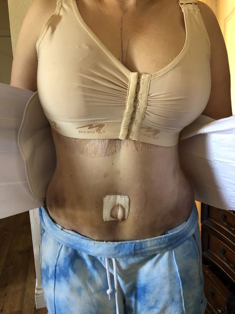 Day after surgery. Bottom Surgery, Mommy Makeover Surgery, Breast Lift Surgery, Plastic Surgery Gone Wrong, Mommy Makeover, Breast Lift, After Surgery, Tummy Tucks, Iphone Wallpaper Girly