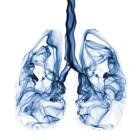 Thorax anatomy Lungs Aesthetic, Lungs Drawing, Lungs Art, Home Remedies For Bronchitis, Best Cough Remedy, Human Lungs, Lung Conditions, Chronic Cough, Chronic Obstructive Pulmonary Disease