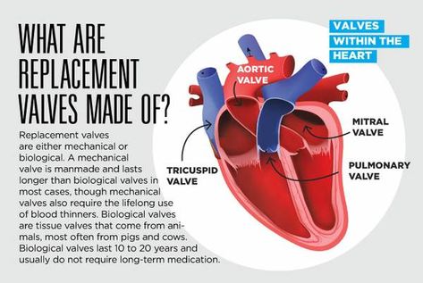 Making heart-valve surgery a little less scary - Las Vegas Sun News Heart Valve Replacement, Heart Stent, Aortic Valve Replacement, Heart Valve, Tricuspid Valve, Mitral Valve, Heart Valves, Open Heart Surgery, Cardiac Nursing