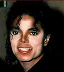 Jermaine Jackson, Motown Records, Pimple Scars, Apple Head, Michael Jackson Rare, Michael Jackson Smile, Laser Skin, White Patches, Face Tattoos