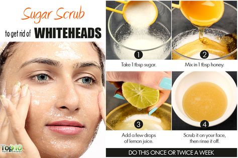 sugar scrub to remove whiteheads Remove Whiteheads, Whiteheads Remedy, Whiteheads Removal, Skin Care For Acne, Hair Removal Laser, Hair Removal Diy, Exfoliating Face Scrub, Scrub Homemade, Remedies For Acne