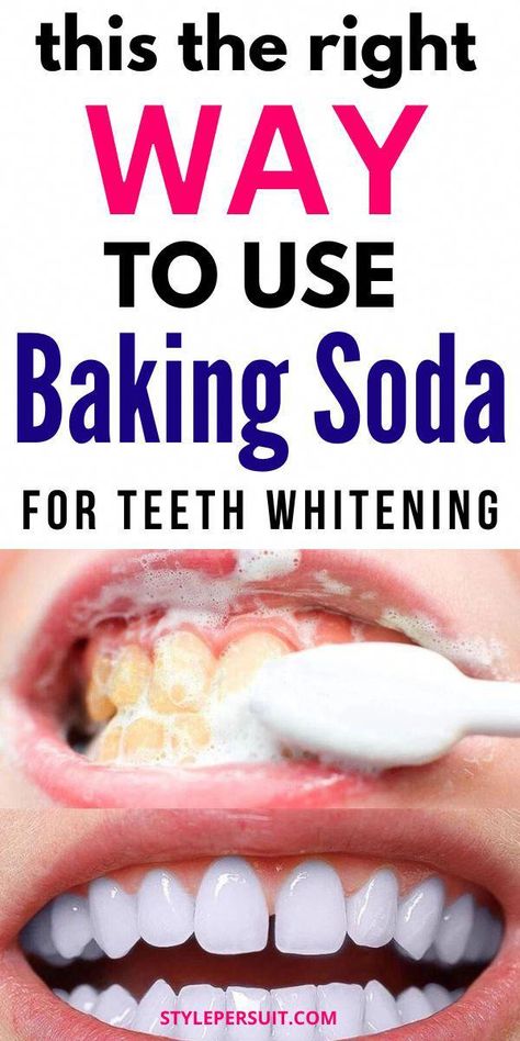 How To Use Baking Soda To Whiten Your Teeth: if you want to explore natural teeth whitening treatments, baking soda is a great option. Read on to know more about the benefits of using baking soda to get pearly white teeth. #teethwhitening #whiteteeth #remedies #homeremedies White Teeth Baking Soda, Natural Remedies For Cavities, Pearly White Teeth, Natural Teeth Whitening Diy, Diy Toothpaste, Baking Soda Teeth Whitening, Teeth Remedies, Teeth Whitening Homemade, Gut Healing Recipes