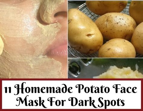 How To Use Potato For Dark Spots On Face Ovenight- Trabeauli Face Mask For Dark Spots, Orange Peel Benefits, Mask For Dark Spots, For Dark Spots On Face, Potato For Skin, Potato Face Mask, Turmeric Face Pack, Spot Remover For Face, Potato Face